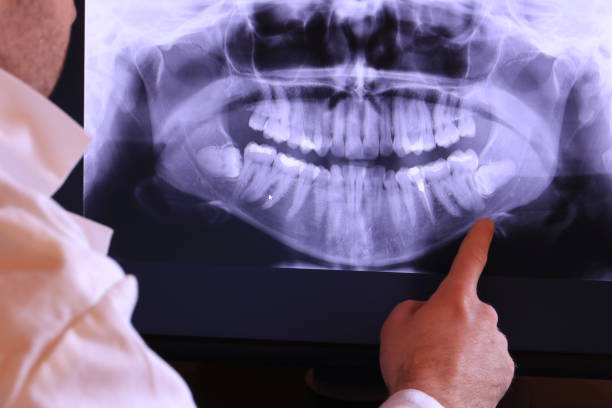 Best Emergency Tooth Extraction in Bethalto, IL